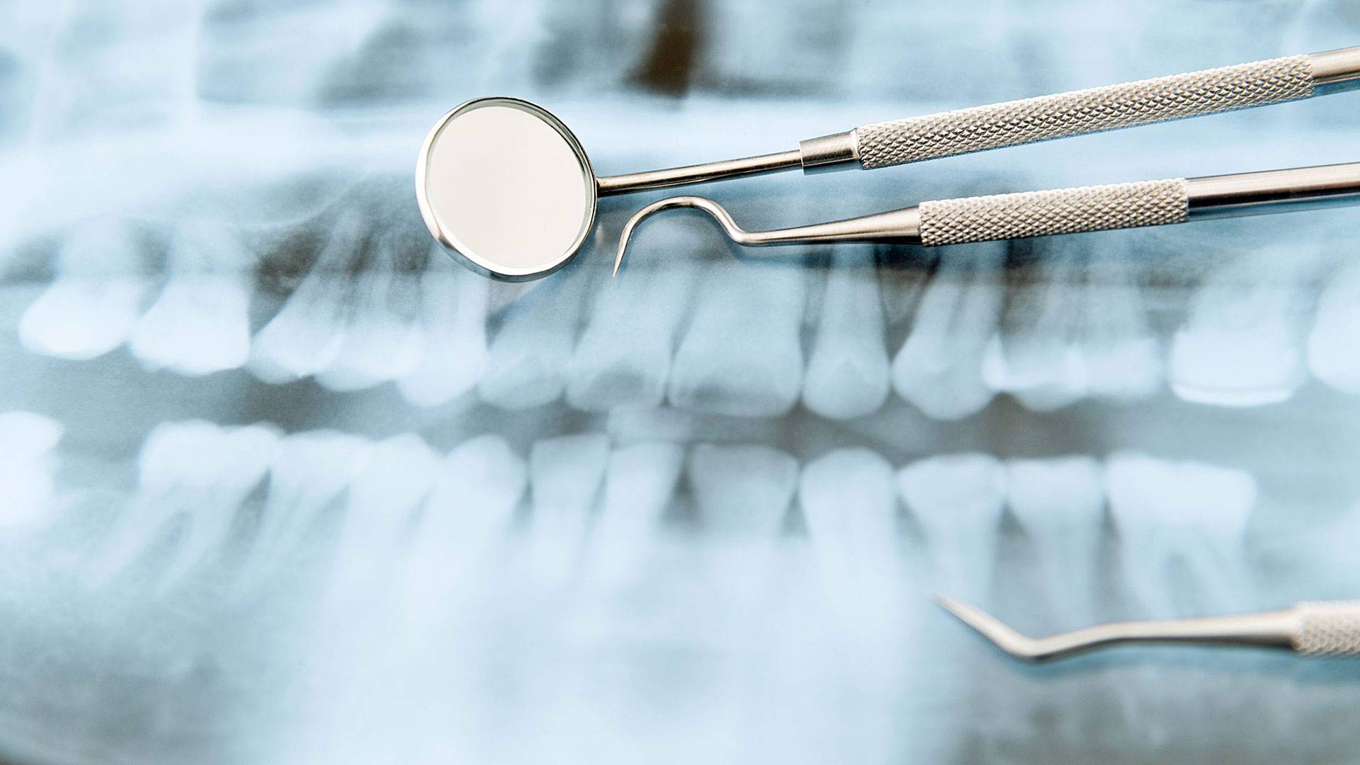 Can Dental X-rays Cause Oral Cancer?