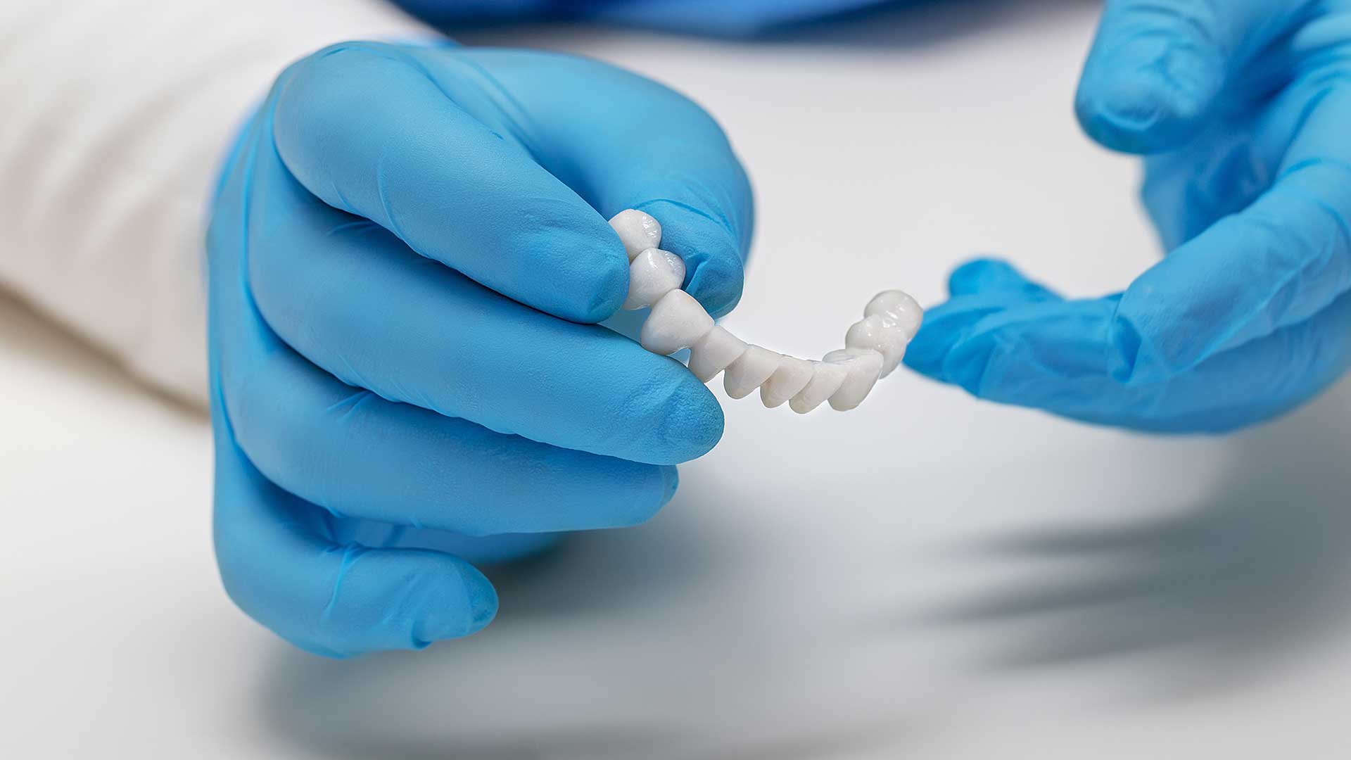 Dental And Denture Care Center, Spring Hill, FL, Alternatives To Dental Implants